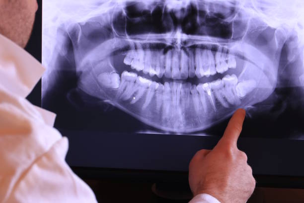 Best Emergency Dental Extractions in Champion Heights, OH